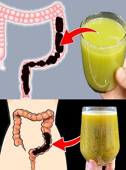 Lose Weight by Cleansing Your Colon