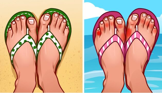 7 reasons to use caution when wearing flip flops