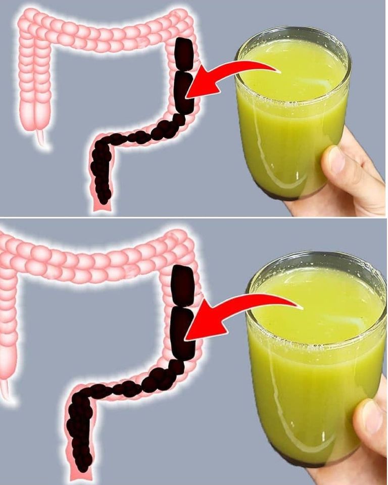 Lose Weight by Cleansing Your Colon in 7 Days