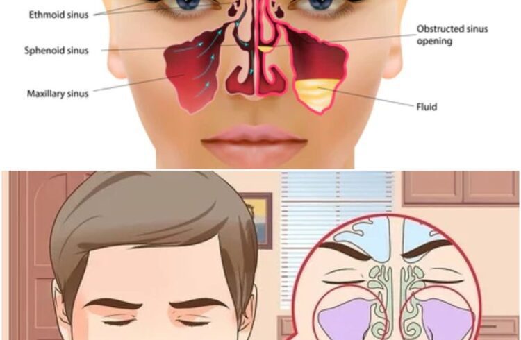 Soothe Your Sinuses The Gentle Art of Sinus Drainage Massage